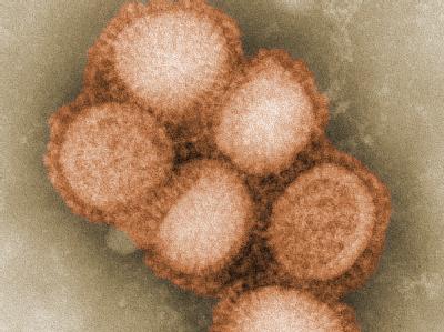 Uwe Gerd Liebert, Direktor des Instituts für Virologie an der Uni Leipzig: «Ich befürchte nur, dass viele Menschen zu spät aufwachen.» Schweinegrippe-Virus