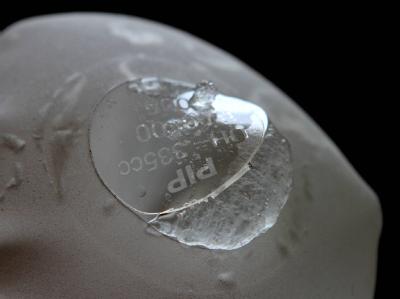 Geöffnetes Brust-Implantat des französischen Unternehmens PIP: Experten raten zu einer vorsorglichen Entfernung. Foto: Photopqr/Nice Matin/Eric Estrade Brustimplantat
