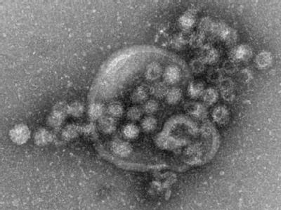 Elektronenmikroskopische Aufnahme von Noroviren Norovirus-Erkrankungen im Südwesten