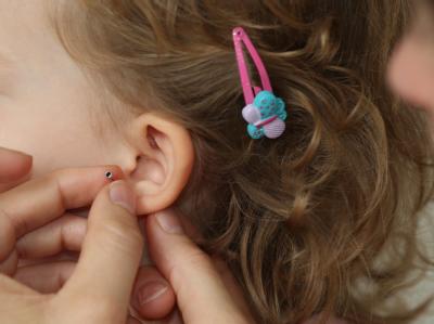 Dürfen Eltern ihren kleinen Kindern Ohrlöcher stechen lassen? Foto: dpa/Symbolbild Ohrstecker bei kleinem Mädchen