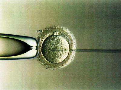 Intra-Cytoplasmatische Sperma-Injektion in einer Frauenklinik (Archivfoto). Künstliche Befruchtung