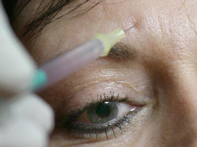 Botox-Spritzen sollen Falten verringern. Faltenbehandlung mit Botox