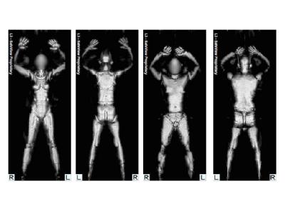 Die Röntgenbilder, die mit Hilfe eines Ganzkörper-Scanners entstanden sind, zeigen eine weibliche und eine männliche Testperson. Bilder eines «Nacktscanners»