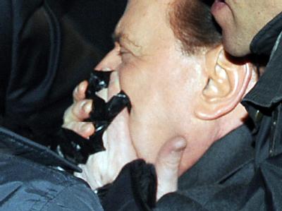 Berlusconi kurz nach der Attacke in Mailand. Berlusconi