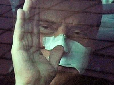 Bandagiert verlässt Silvio Berlusconi das Krankenhaus. Berlusconi verlässt Krankenhaus