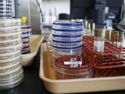 NDM-1-Bakterien beunruhigen die Mikrobiologen. Superbakterium