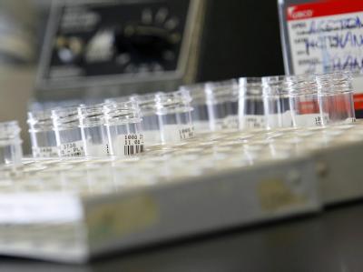 In Belgien ist ein Mann an einem Bakterium gestorben, dass sogar gegen die Carbapeneme resistent ist. Das sind Reserveantibiotika, die nur bei schwer zu behandelnden Infektionen zum Einsatz kommen. Superbakterium NDM-1