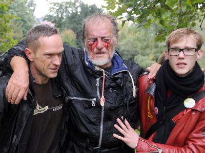 Das Bild des verletzten Demonstranten wurde in den Medien ein Symbol für die Härte des Polizeieinsatzes in Stuttgart. Stuttgart 21-Demonstrant