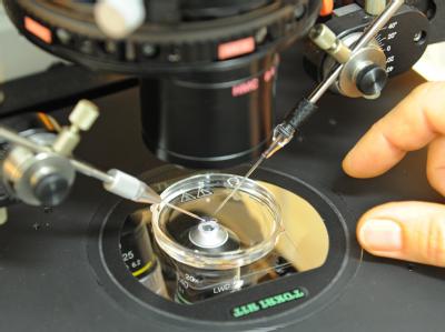 Eine Laboringenieurin injiziert unter dem Mikroskop Spermien in Eizellen, die kurz vorher bei einer Patientin während einer Operation entnommen wurden. (Archivbild) Präimplantationsdiagnostik