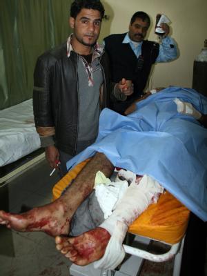 Ein Anschlagsopfer wird im Krankenhaus von Tikrit versorgt. Anschlagsopfer in Tikrit