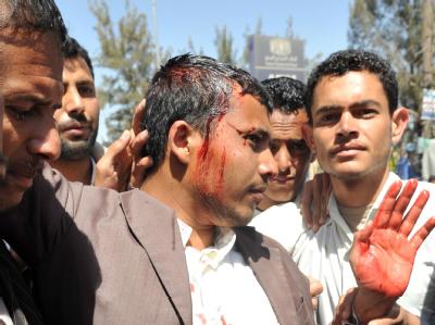 Ein verletzter Demonstrant nach Auseinandersetzungen zwischen Regierungsanhängern und Oppositionellen in Sanaa. Verletzt