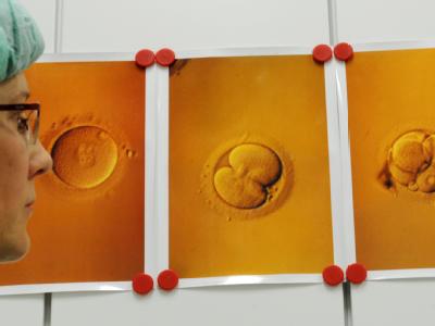 Abbildungen von Eizellen mit Spermien nach einer künstlichen Befruchtung im Labor des Zentrums für Reproduktionsmedizin in Leipzig. PID