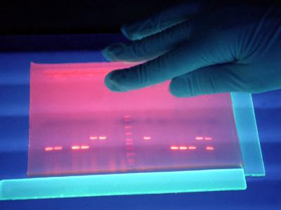 Untersuchung von fluoreszierender DNS von EHEC-Bakterien in einem Labor in der Außenstelle Wernigerode des Robert-Koch-Instituts. EHEC-Erreger infiziert