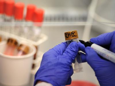 Im Universitätsklinikum Hamburg-Eppendorf (UKE) werden Stuhlproben auf EHEC-Bakterienstämme untersucht. Im Labor