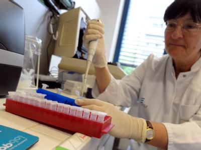 Martina Bielaszewska vom Institut für Hygiene der Universitätsklinik in Münster bestückt ein Realtime PCR-Gerät für einen molekular-biologischen Schnelltest für den Nachweis von EHEC-Bakterien. EHEC-Schnelltest