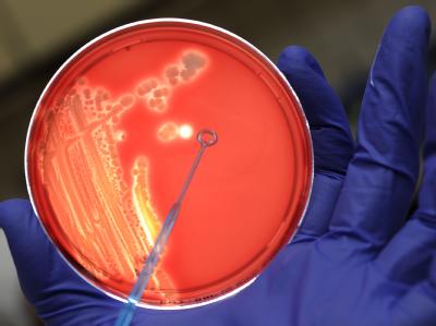 Wissenschaftler aus Hamburg und China haben die Erbsubstanz des EHEC-Bakteriums entschlüsselt. Suche nach EHEC-Quelle