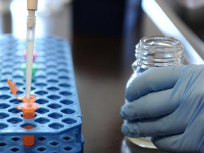 Eine Mitarbeiterin des Veterinärinstitut Hannover bereitet einen Test vor. Suche nach EHEC-Erreger