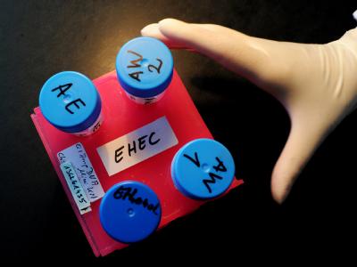 Die Zahl der EHEC-Neuinfektionen geht zurück - aber immer noch sterben Menschen an den Folgen des Darmkeims. Bis Donnerstag waren es in Europa schon 39. Die Experten warnen weiter vor rohen Sprossen. EHEC