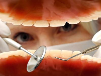 Kunststofffüllungen, Brücken oder Kronen werden für Kassenpatienten künftig möglicherweise deutlich teurer. Behandlung