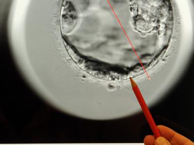 Im Kinderwunschzentrum Leipzig ist auf einem Bildschirm ein mit einem EmbryoScope aufgenommener 5 Tage alter Embryo abgebildet: Kinderwunschbehandlung
