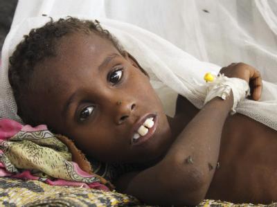 Ein hungerndes Kind in einem Flüchtlingslager in Mogadischu. Hungersnot