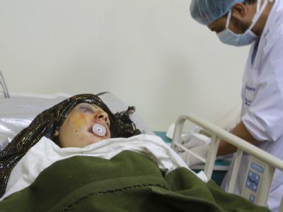 Schwerverletzte Afghanin im Krankenhaus: Bei den Anschlägen wurden 23 Zivilisten getötet. Schwerverletzt