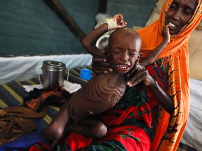 Eine somalische Mutter hält ihr unterernährtes Kind in einer Klinik von Ärzte ohne Grenzen im Lager Dagahaley in Kenia im Arm. Foto: Dai Kurokawa Hungersnot in Afrika
