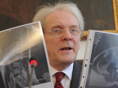 Der Leiter der Charite, Karl M. Einhäupl, mit Kernspin-Aufnahmen, die den Bandscheibenvorfall von Julia Timoschenko dokumentieren. Foto: Bernd Settnik/Archiv Behandlungsmöglichkeiten für Julia Timoschenko