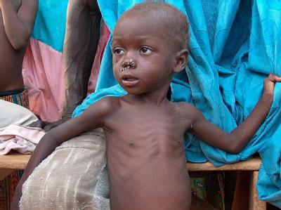 Unterernährtes Kind im Niger: Rund 16 Prozent der Weltbevölkerung leiden bis heute an Hunger. (Archivbild) Hungersnot