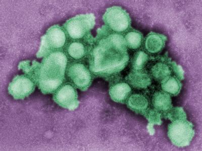 Ein Schweinegrippevirus, aufgenommen von der US-Seuchenkontrollbehörde CDC. Schweinegrippevirus