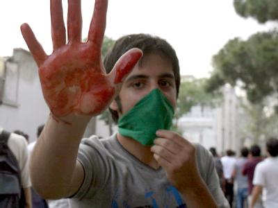 In Teheran hebt ein Demonstrant seine blutige Hand. Iran erlebt die schwersten Unruhen seit 30 Jahren. Unruhen in Teheran