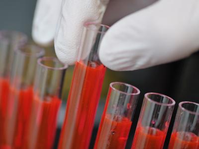 In Bremen hat eine Ehefrau giftigen Fruchtsaft getrunken. Foto: dpa Gift Reagenzglas