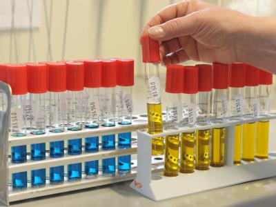 Salmonellen-Test im Thüringer Landesamt für Lebensmittelsicherheit und Verbraucherschutz (Archiv). Salmonellen-Test