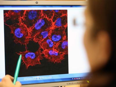 Im Labor des Instituts für Experimentelle Gentherapie und Tumorforschung der Uni Rostock schaut eine Doktorandin auf ein Monitorbild von Melanom-Zellen. Foto: Bernd Wüstneck Aufklärung von Tumor-Metastasierung