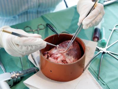 Mit mikrochirurgischen Instrumenten wird an einem Schweineherz in der Uniklinik in Frankfurt am Main operiert. Schweineherz