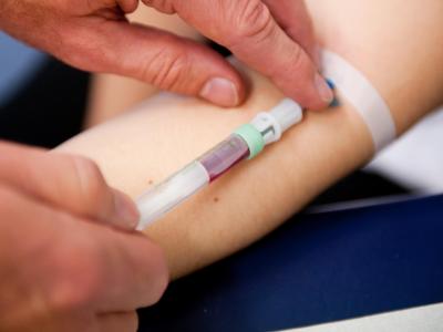 Seit 2012 werden Schwangeren Bluttests auf eigene Kosten angeboten, mit denen unter anderem untersucht wird, ob das Kind mit Down-Syndrom auf die Welt käme. Bluttest