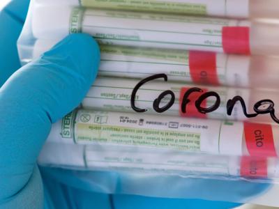 Proben mit Abstrichen werden in einem Labor auf das Coronavirus untersucht. Corona-Tests