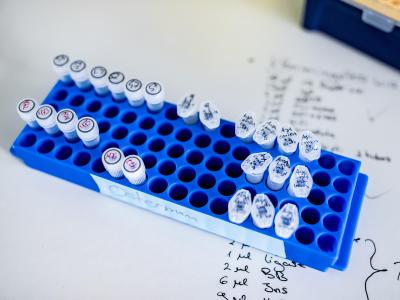 Proben für die Coronavirus-Forschung stehen auf einem Tisch einem Labor der Heinrich-Heine-Universität Düsseldorf. Im Labor